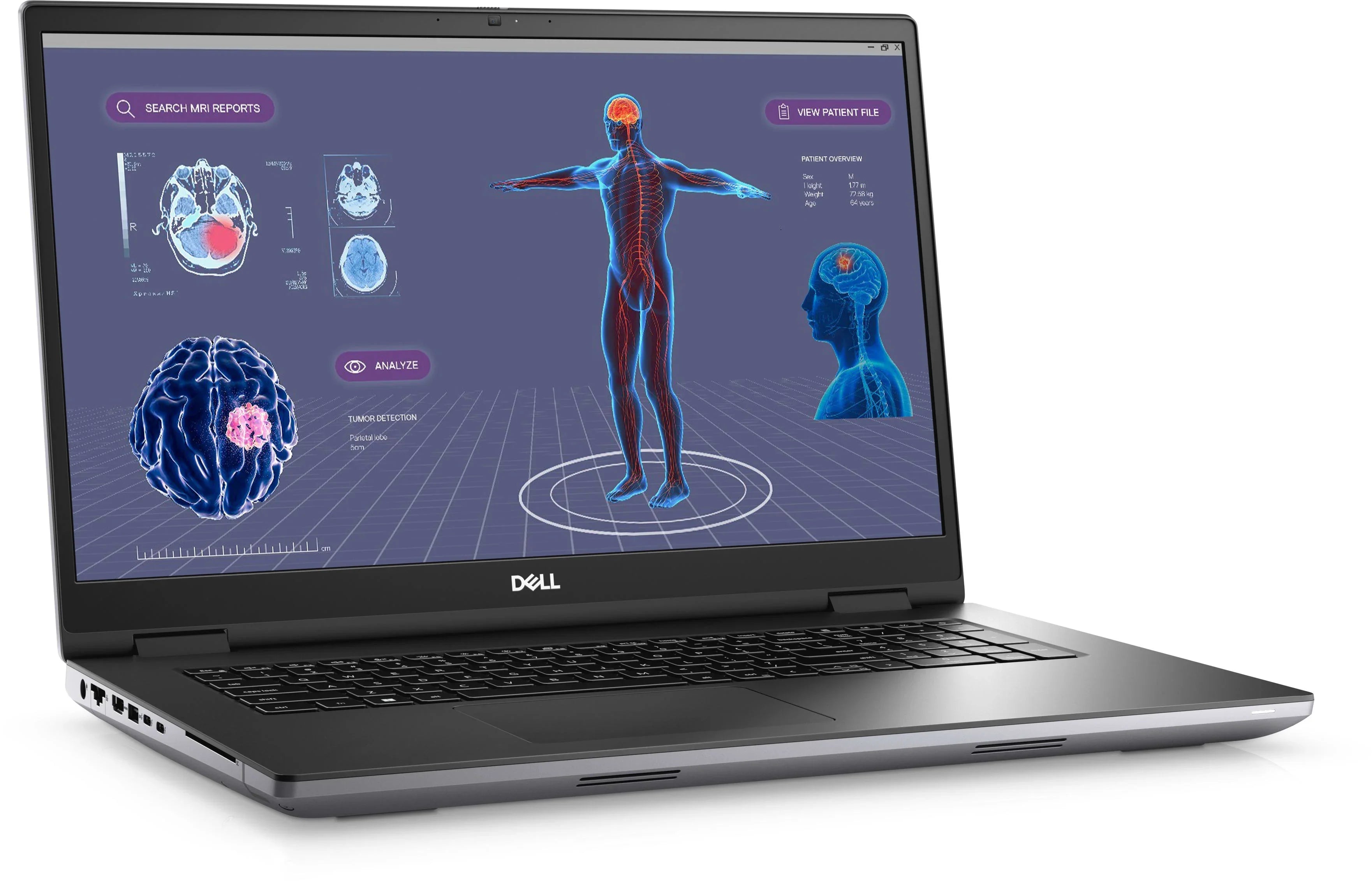 Renewed Dell Precision 7000 7780 Workstation Notebook (2023) | 17" FHD | Core i9 - 1TB SSD - 64GB RAM | 24 Cores @ 5.5 GHz - 13th Gen CPU
